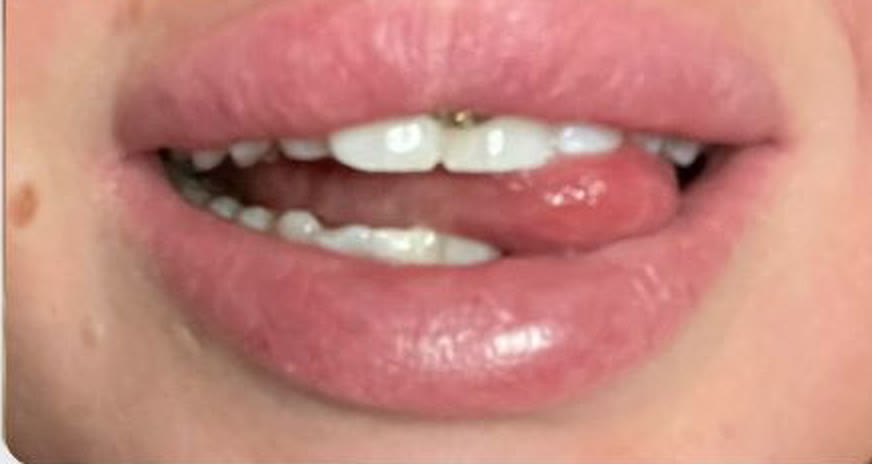 Jill's teeth photographed after the twelve day course
