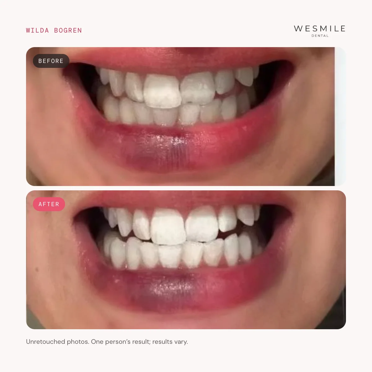 Wilda Bogren, before and after the course